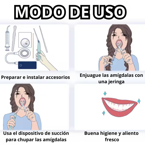 IRRIGADOR ORAL SUBSIONADOR DE TONSILOLITOS